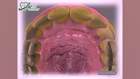 ونیرهای مستقیم MRCP