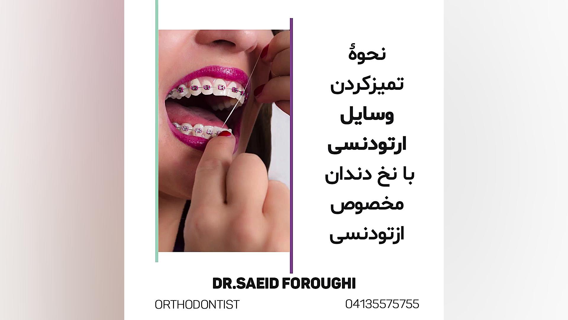 نحوه تمیز کردن وسایل ارتودنسی با نخ دندان مخصوص ارتودنسی حتما روزی یکبار از نخ د دکتر سعید فروغی متخصص ارتودنسی