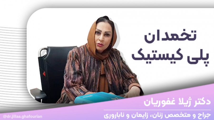 سندرم تخمدان پلی‌کیستیک