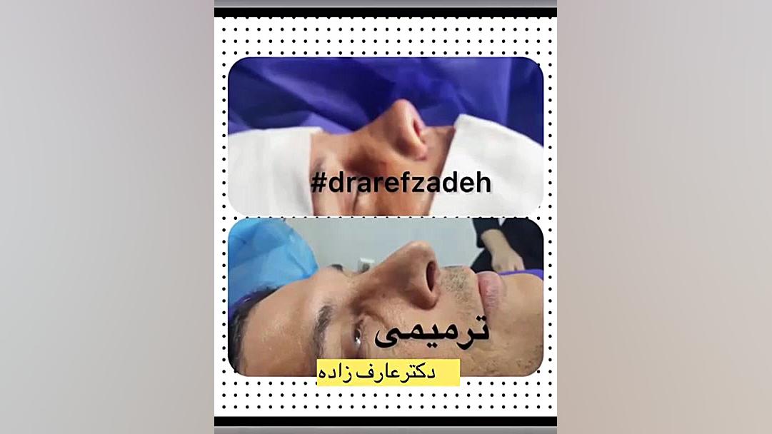 دکتراسماعیل عارف زاده، متخصص گوش ،حلق، بینی ،ساری ترمیم زیبایی دندان
