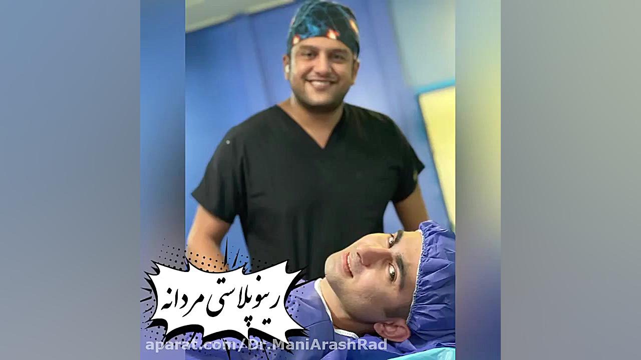 رینوپلاستی مردانه (عمل زیبایی بینی و رفع انحراف) دکتر مانی آرش راد جراح فك و صورت