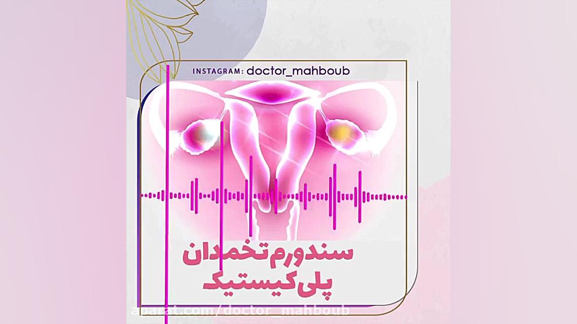 سندوم تخمدان پلی کیستیک چگونه قابل درمان است؟ زیبایی پوست