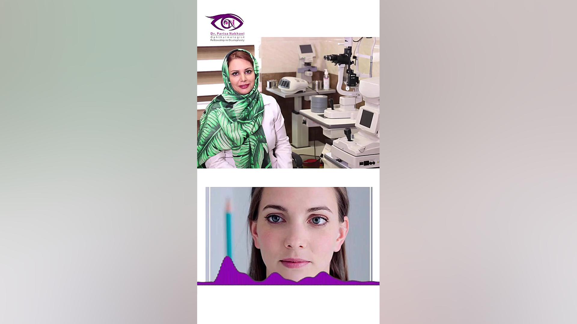 جراحی انحراف چشم پزشکی میکروRNA