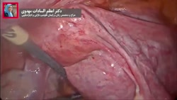 فیلم واقعی و بدون سانسور خارج...