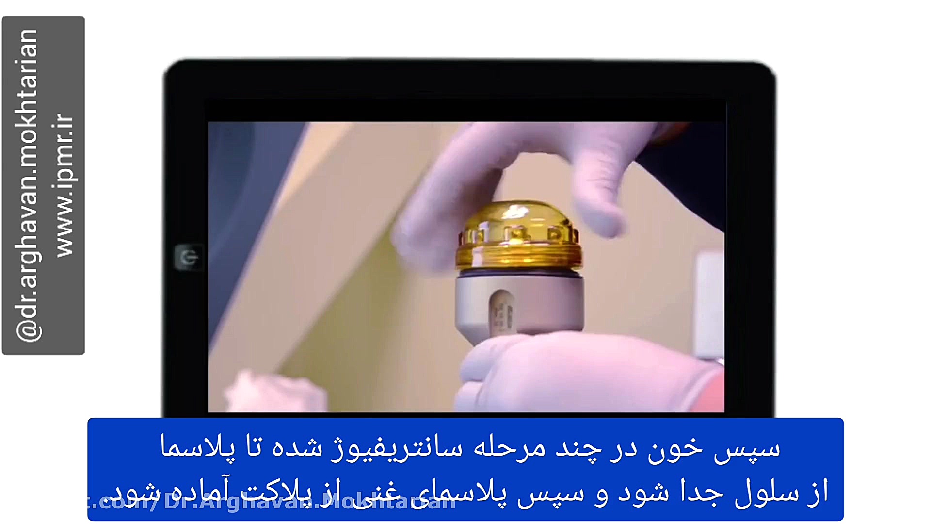 تزریق پی آر پی یا پلاسمای غنی از پلاکت برای بهبود درد (PRP) دکتر ارغوان مختاریان