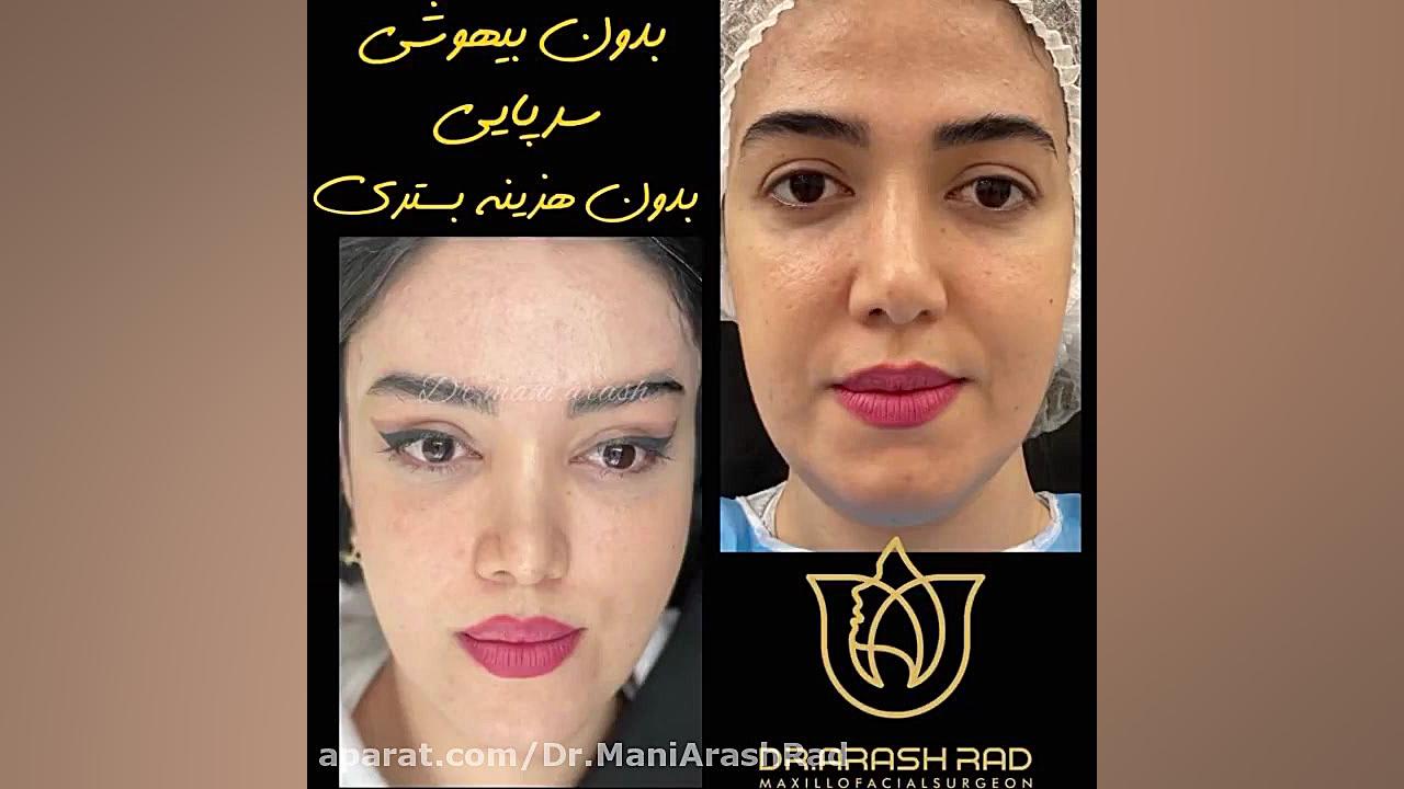 لیپوغبغب، بلفاروپلاستی، لیفت شقیقه دکتر مانی آرش راد جراح فك و صورت