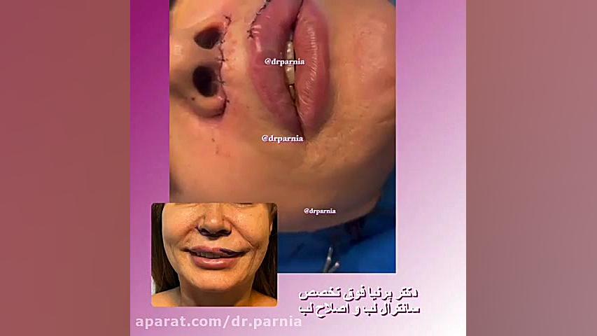 سانترال لب دکتر رفیع پرنیا فوق تخصص پلاستیک