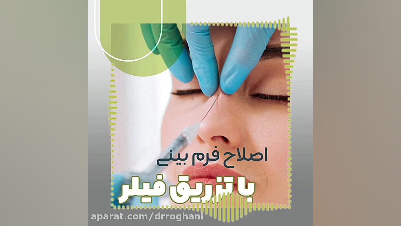 اصلاح فرم بینی با تزریق فیلر دکتر ایمان روغنی جراح و متخصص پوست و مو