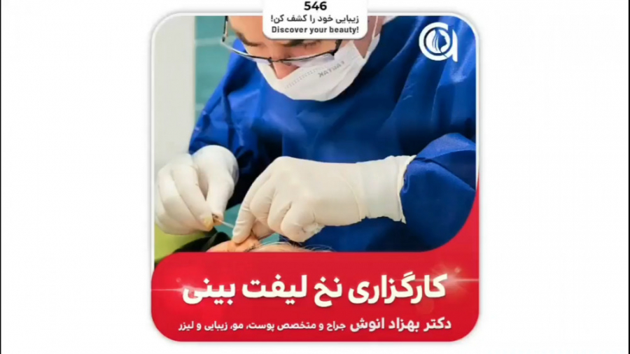 کارگذاری نخ لیفت بینی دکتر بهزاد انوش|متخصص و جراح پوست مو زیبایی و لیزر