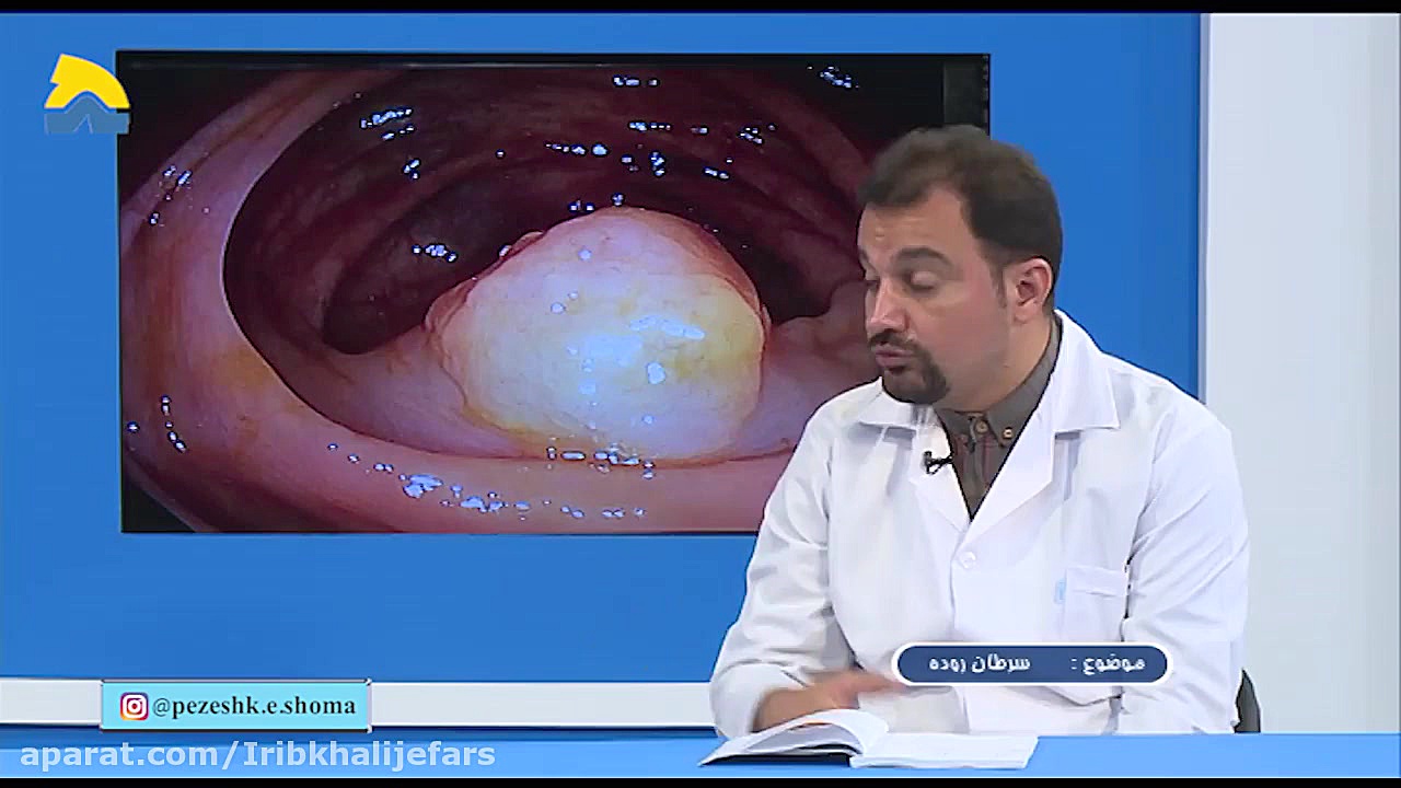 علائم سرطان روده عمل زیبایی