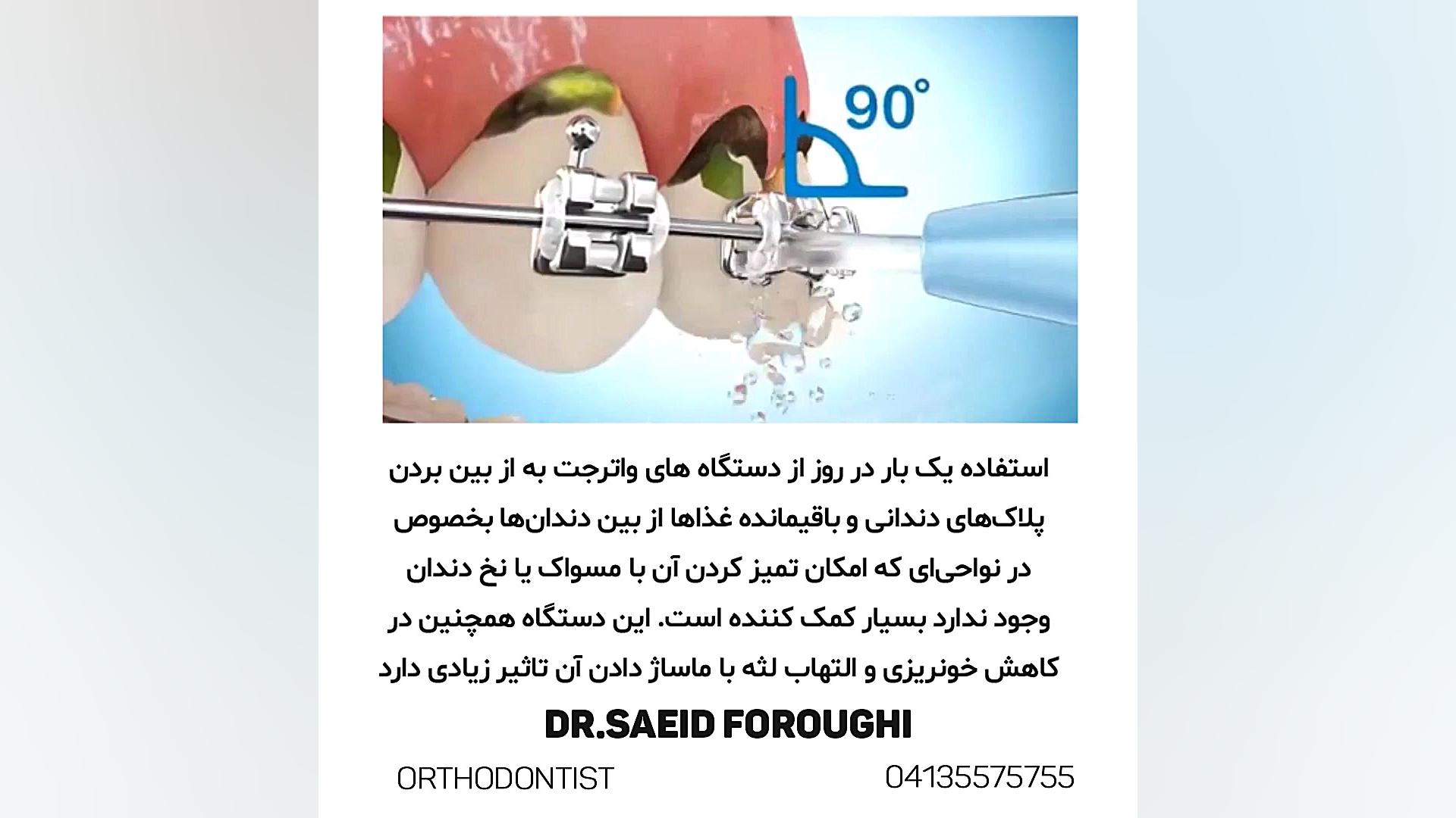 Oral Irrigation دکتر سعید فروغی متخصص ارتودنسی