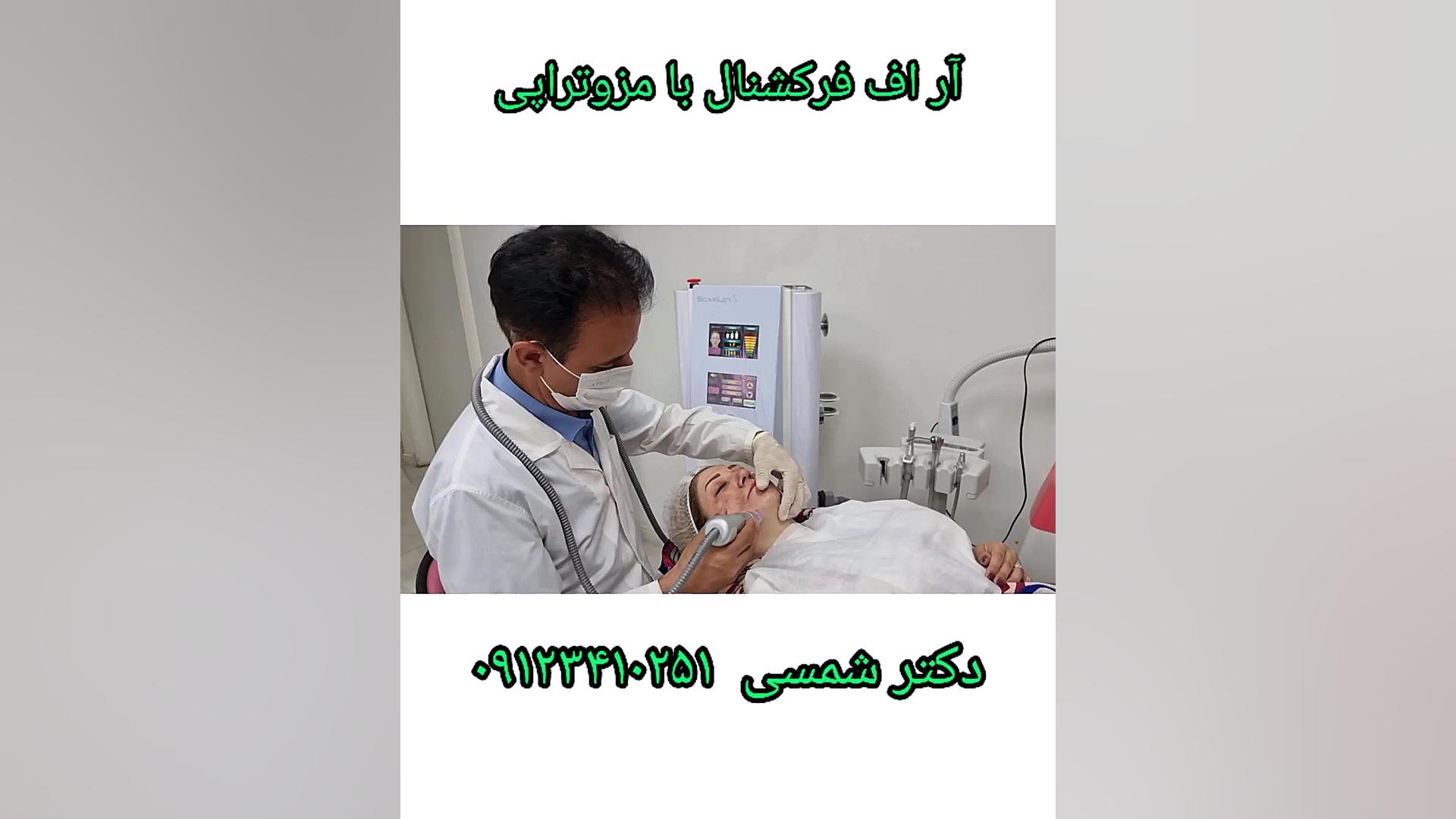 جوانسازی پوست با انجام آر اف فرکشنال و پی آر پی Anti-CCP