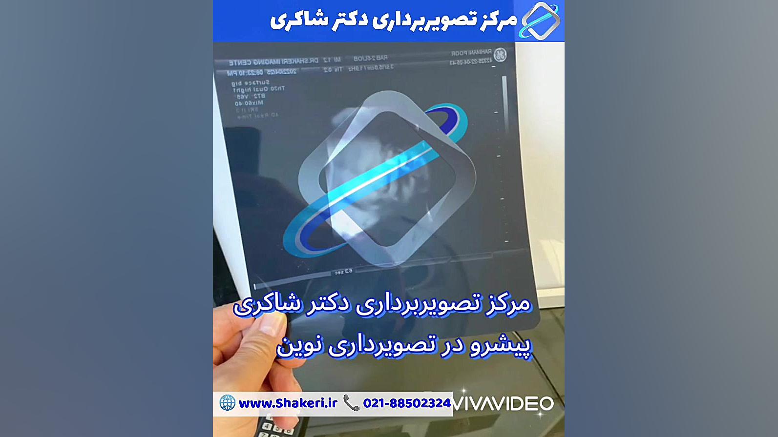 چاپ عکس چهار بعدی جنین روی فیلم رادیولوژی پوسیدگی دندان