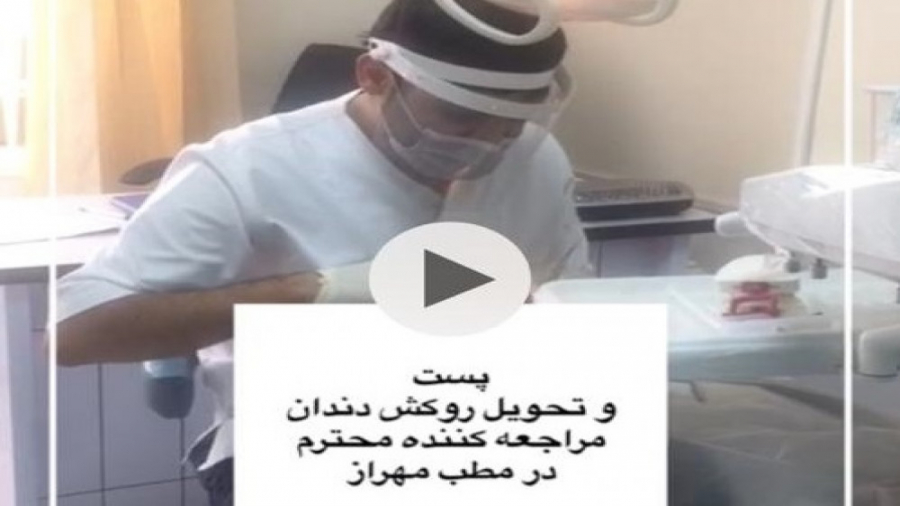 پست و روکش دندان سنداکتیلی