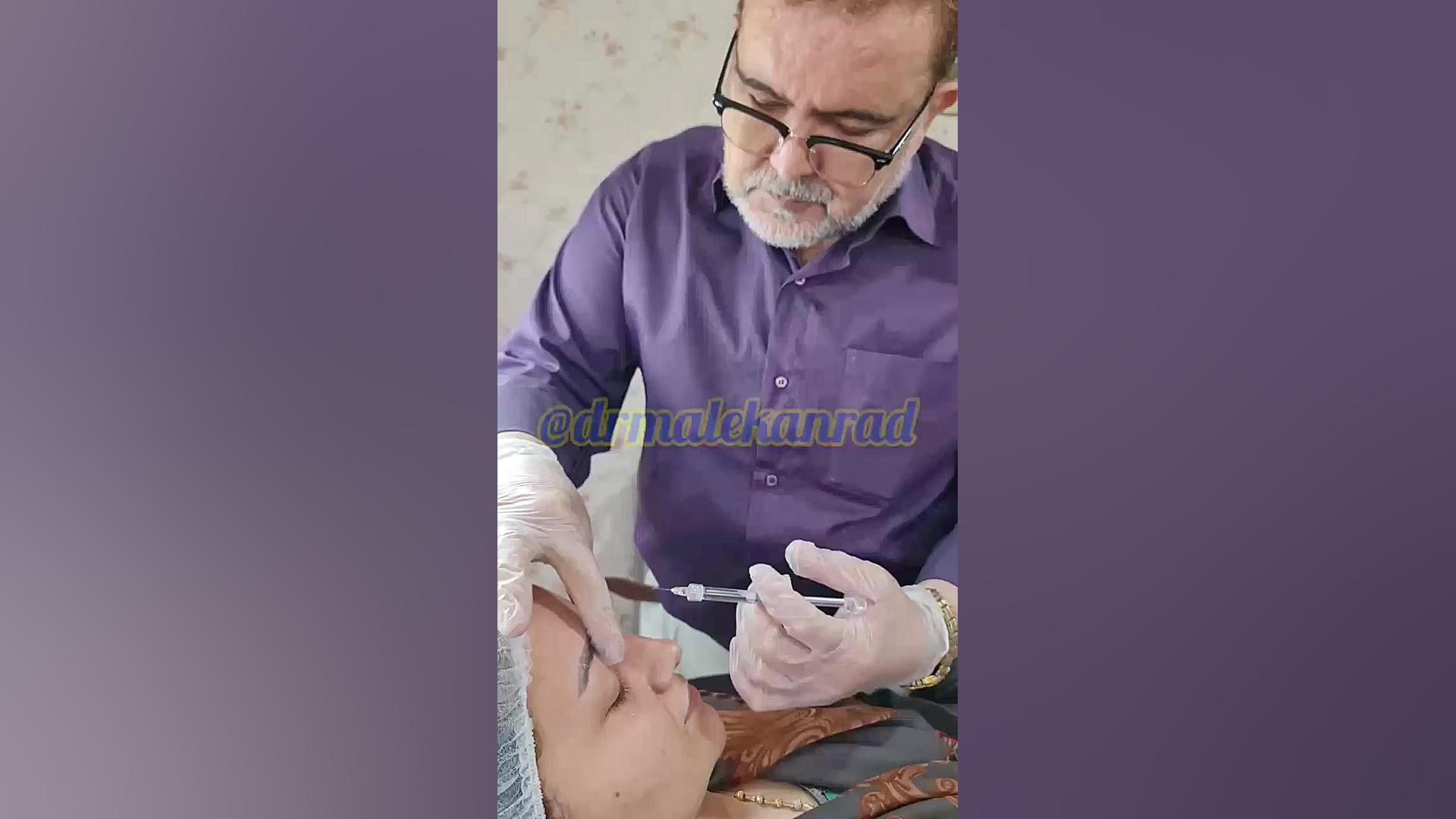 فیلم کامل آموزش فیلر بینی (و مشاهده نتیجه تزریق ژل) 09336093000 گرگان سحر دولتشاهی