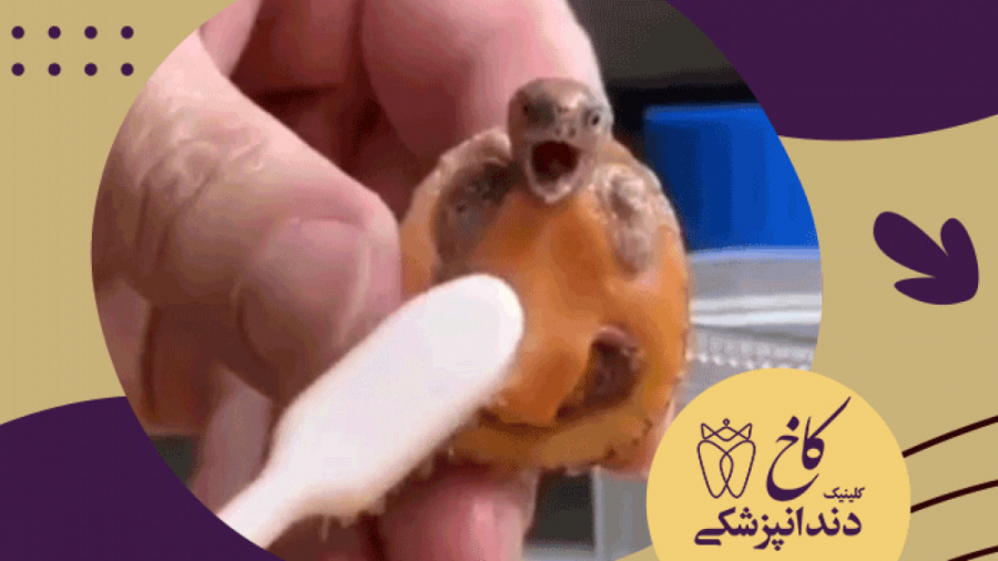 از کاربردهای جالب مسواک کلینیک دندانپزشکی کاخ