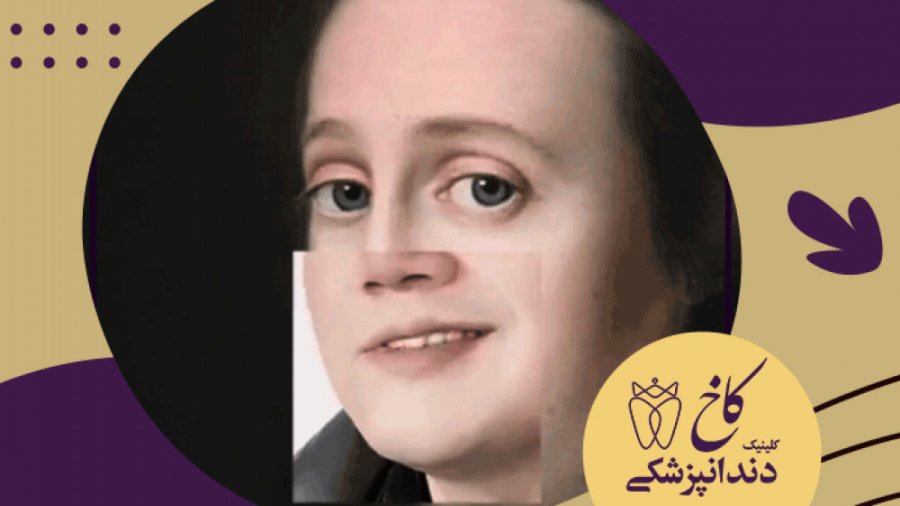 تاثیر لبخند در زیبایی چهره کلینیک دندانپزشکی کاخ