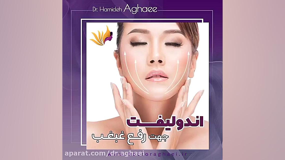 فیلم اندولیفت غبغب دکتر حمیده آقایی