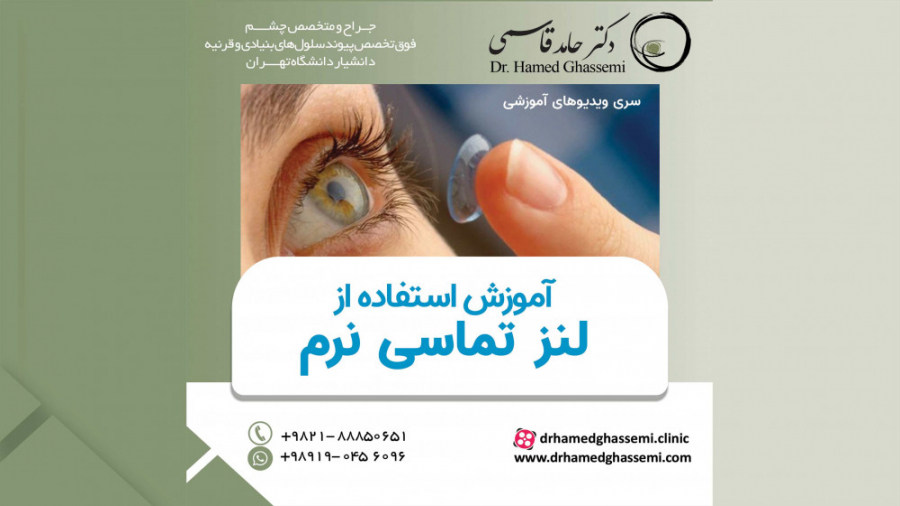 آموزش استفاده از لنز تماسی نرم اینسایزینگ