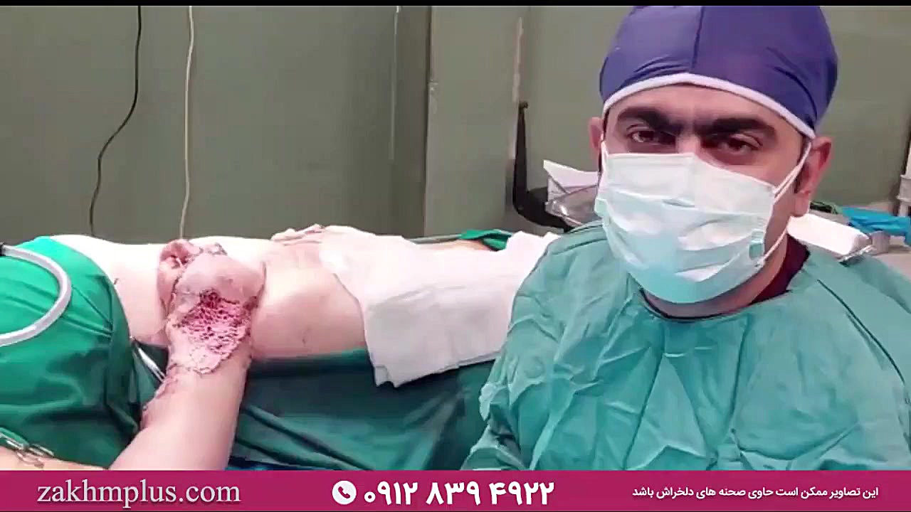 جراحی پیوند عروق و جراحی ارتوپدی بیمار میانسال درمان سلولیت