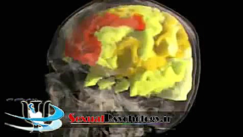 نگاهی به مغز یک خانم در هنگام ارگاسم در زیر دستگاه MRI زیبایی پوست