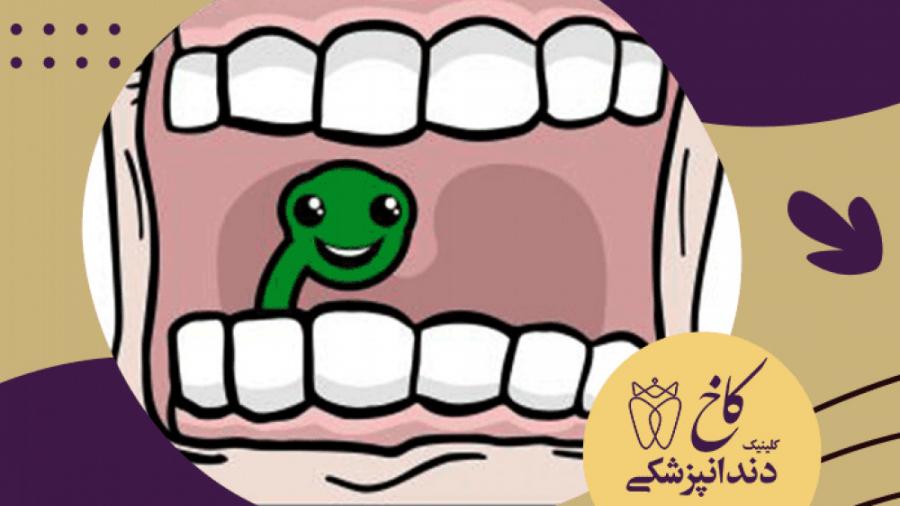 کرم دندان واقعا وجود داره؟؟ کلینیک دندانپزشکی کاخ