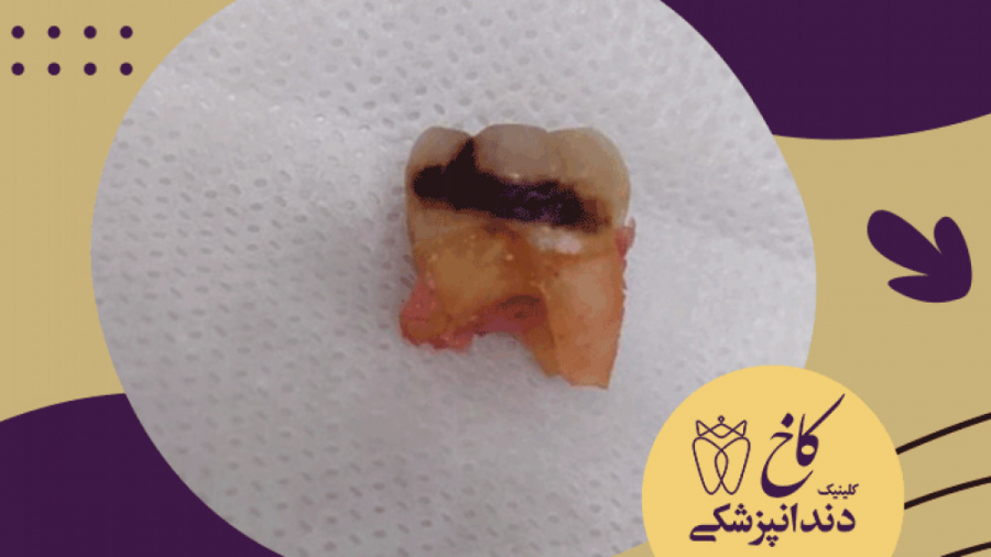 هیکلون وار غیرتون یخ! کلینیک دندانپزشکی کاخ