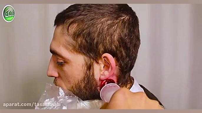 آموزش عملی حجامت پشت گوش (رایحه سلامتی) لیفت صورت
