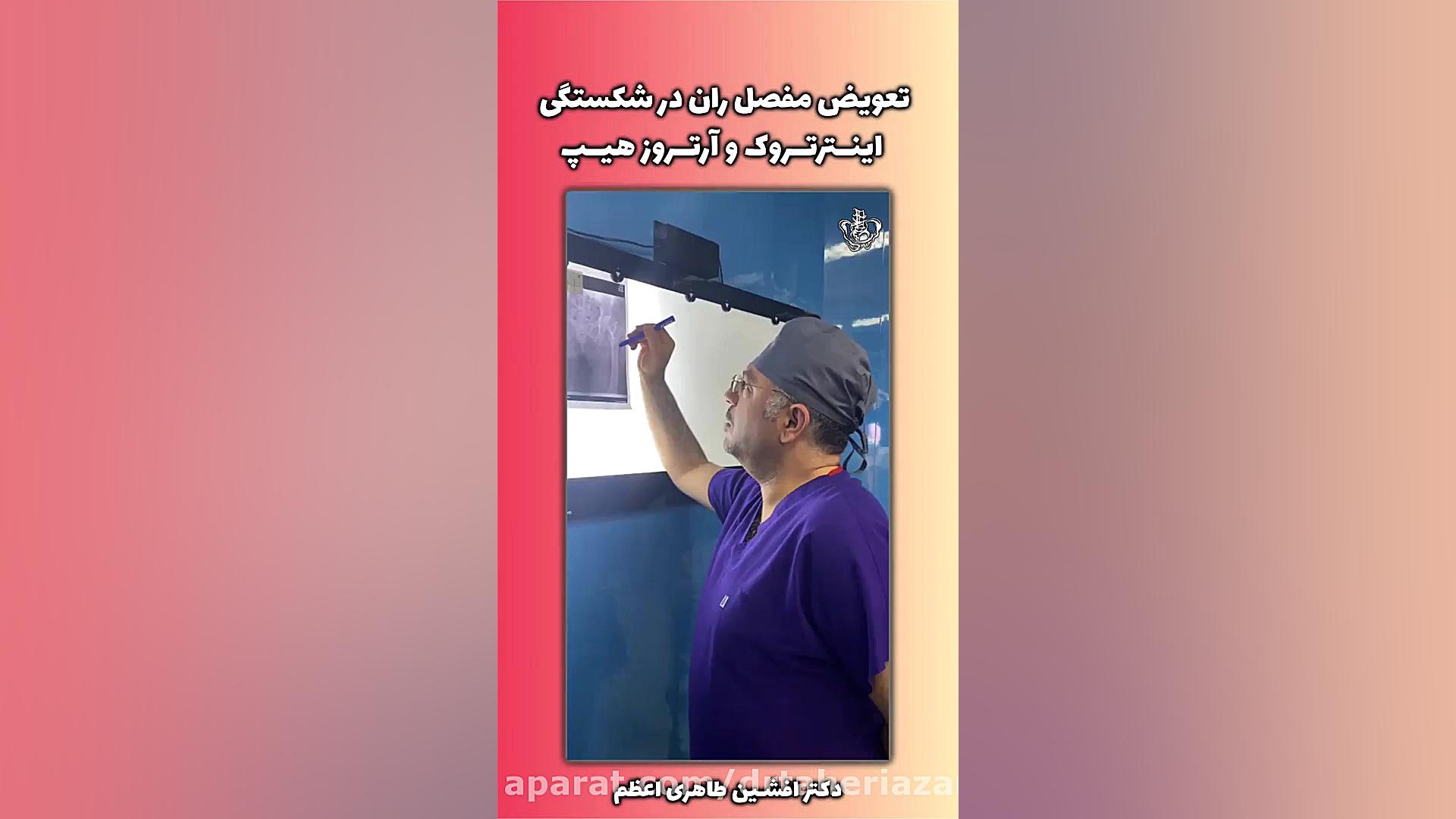 تعویض مفصل ران در شکستگی اینترتروک و آرتروز شدید ویدیو قندی