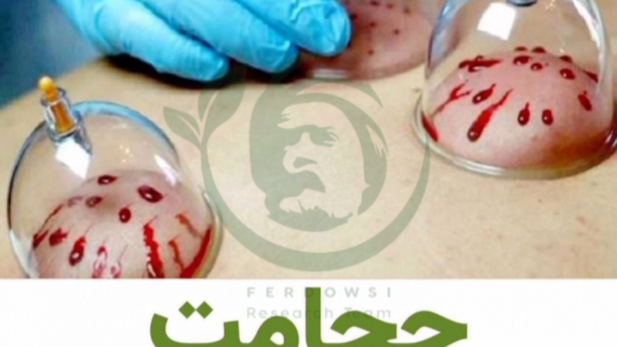 حجامت برای پیسی ویتیلیگو برص بهاق vitiligo علیرضا قربانی