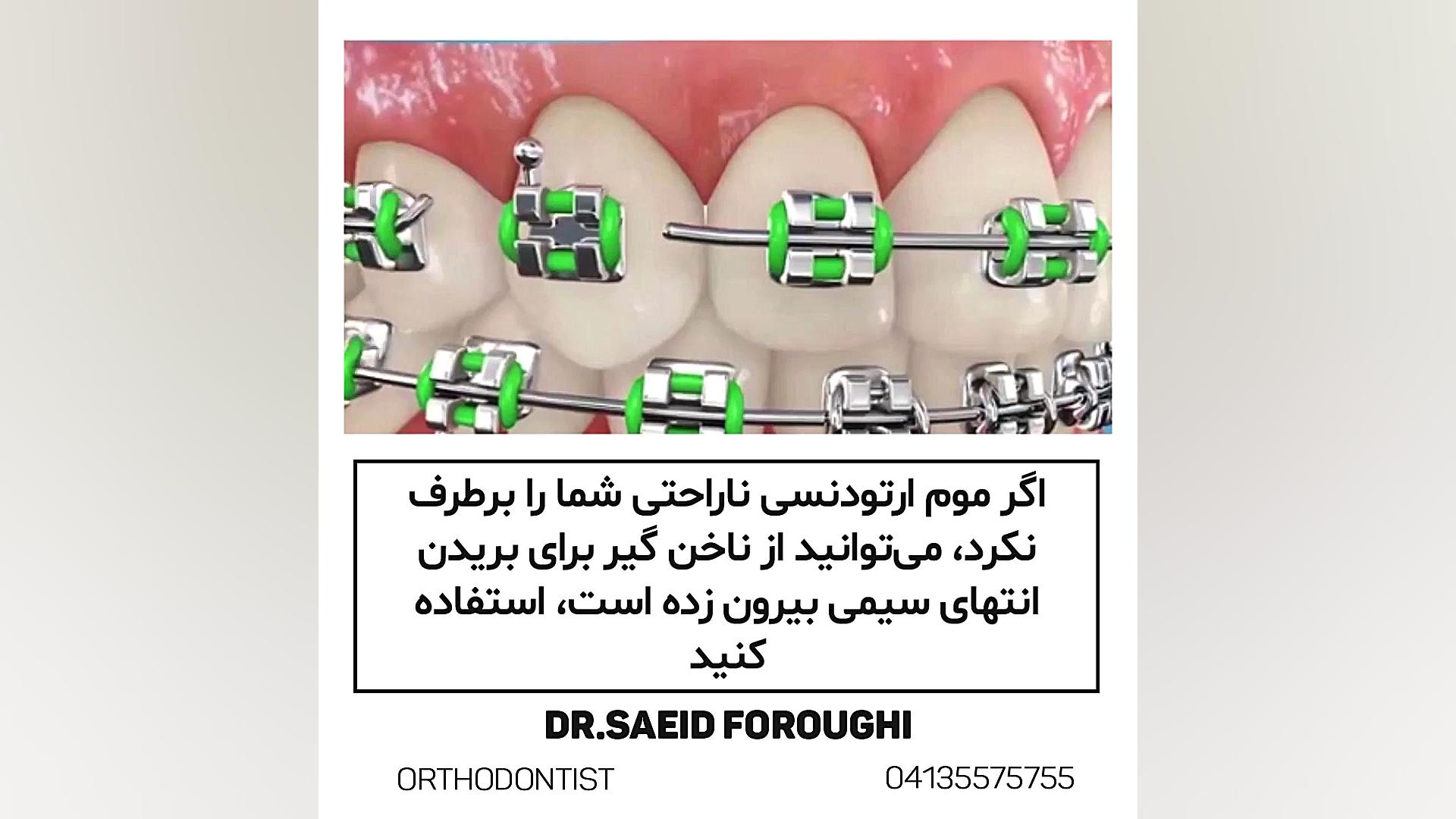 ارتودنسی دکتر سعید فروغی متخصص ارتودنسی