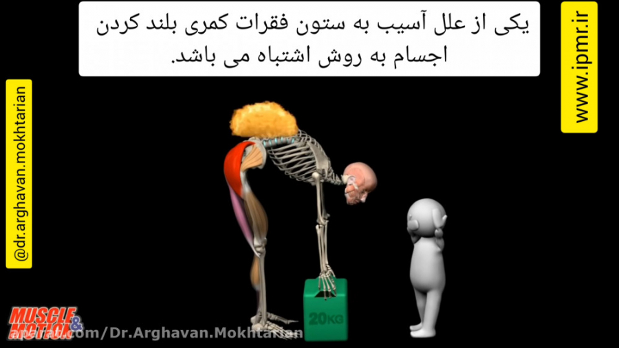 نحوه بلند کردن اجسام سنگین دکتر ارغوان مختاریان