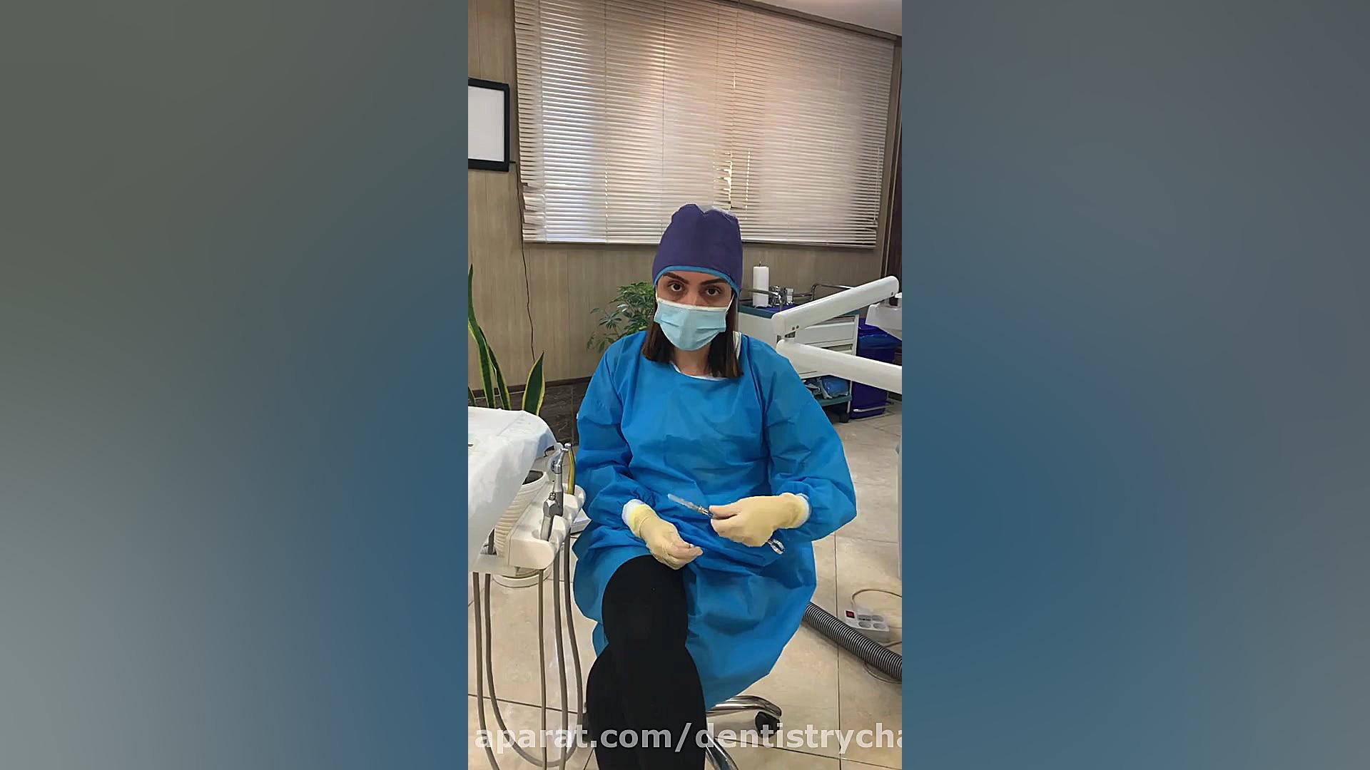 دستیار دندانپزشکی - عصب کشی دندان اطفال تزریق ژل
