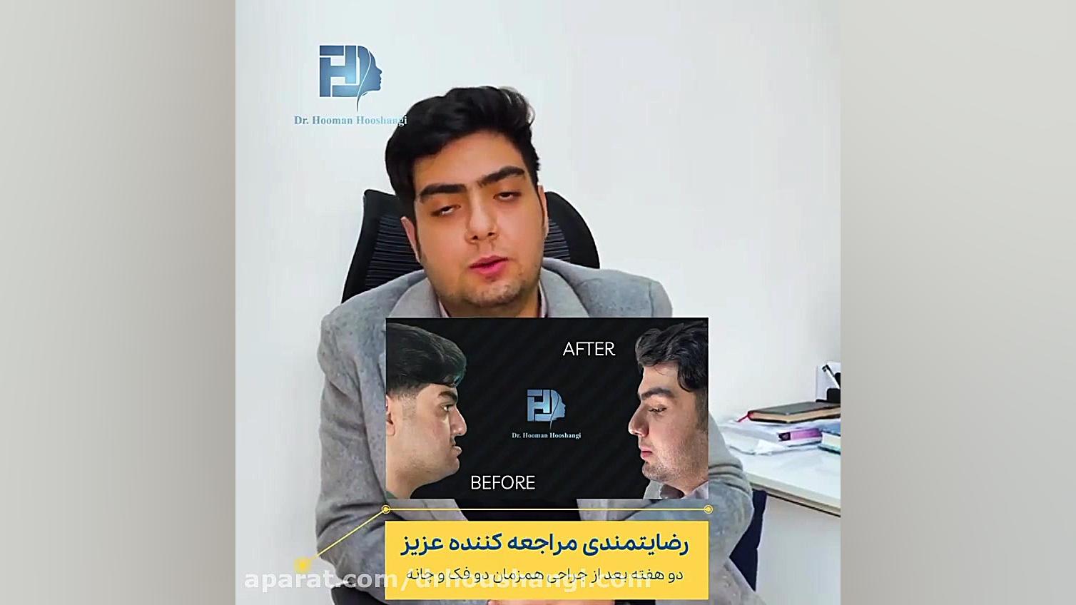 رضایت مراجعه کننده عزیز - ساکشن غبغب و گونه ANCA