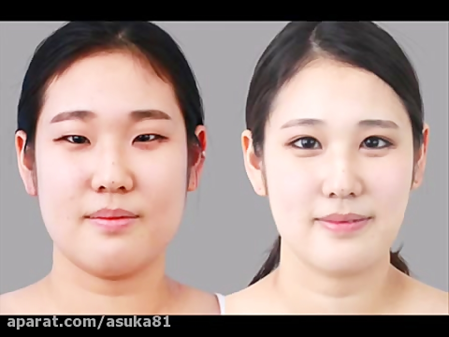 باز هم جراحی زیبایی کره ایها 