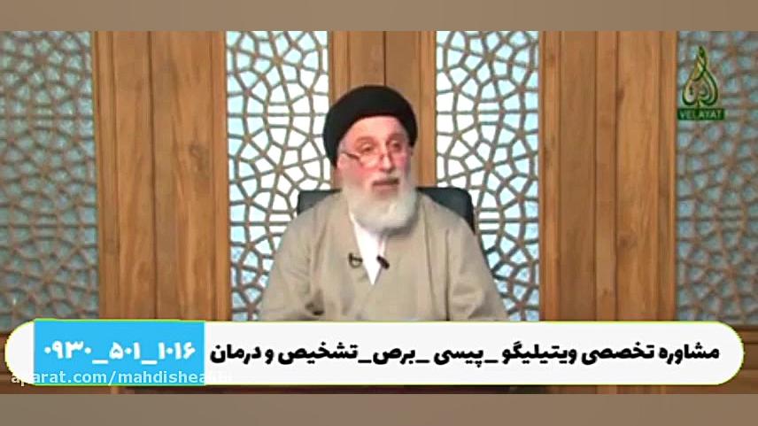 درمان بهاق ویتیلیگو برص در طب اسلامی طب سنتی vitiligo لک و پیس مایکل جردن