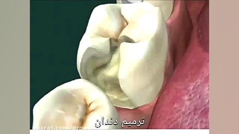 فیلم ترمیم دندان (قسمت اول) scATAC-Seq