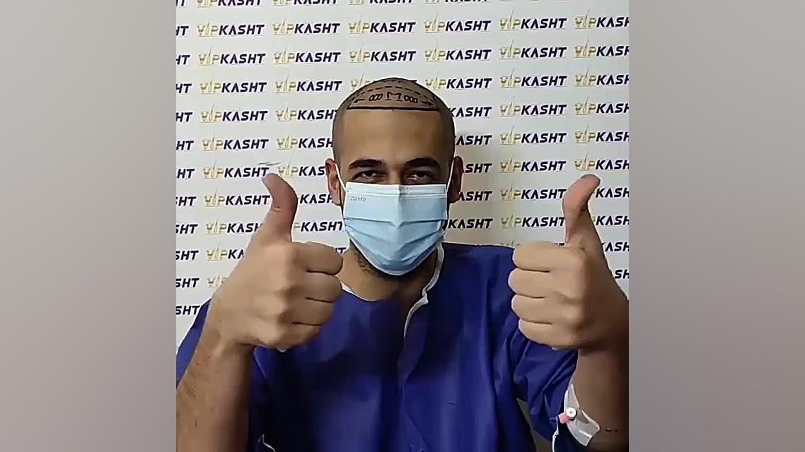 کاشت مو و معرفی بهترین روش کاشت مو-کلینیک vip بررسی لک صورت