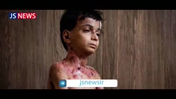 هدیهای از پاریس برای پسربچه بیمار و زن مبتلا به سرطان هدیهای از پاریس برای پسربچه بیمار و زن مبتلا به سرطان