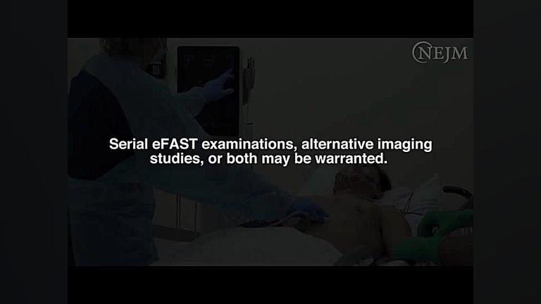 ۰۷۰۲- آشنایی با پروتوکل سونوگرافی E-FAST در بررسی و معاینه‌ی بیماران تروما برداشتن توده