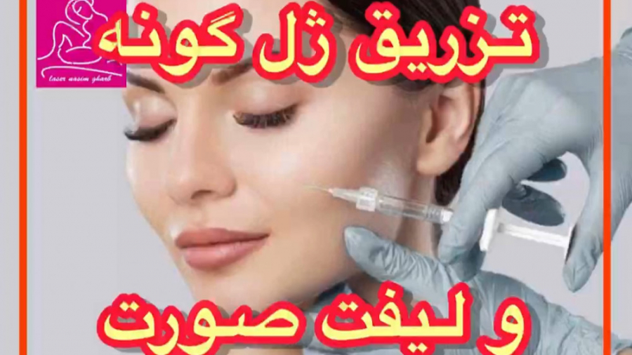 تزریق ژل گونه و لیفت صورت هموکروماتوز