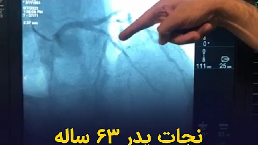 نجات پدر ۶۳ ساله از نارسایی قلبی روکش دندان