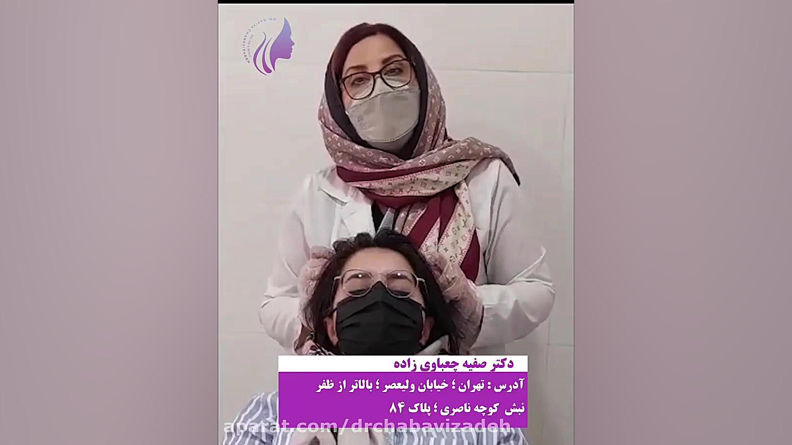 درمان ریزش مو بعد از کرونا دکتر صفیه چعباوی زاده