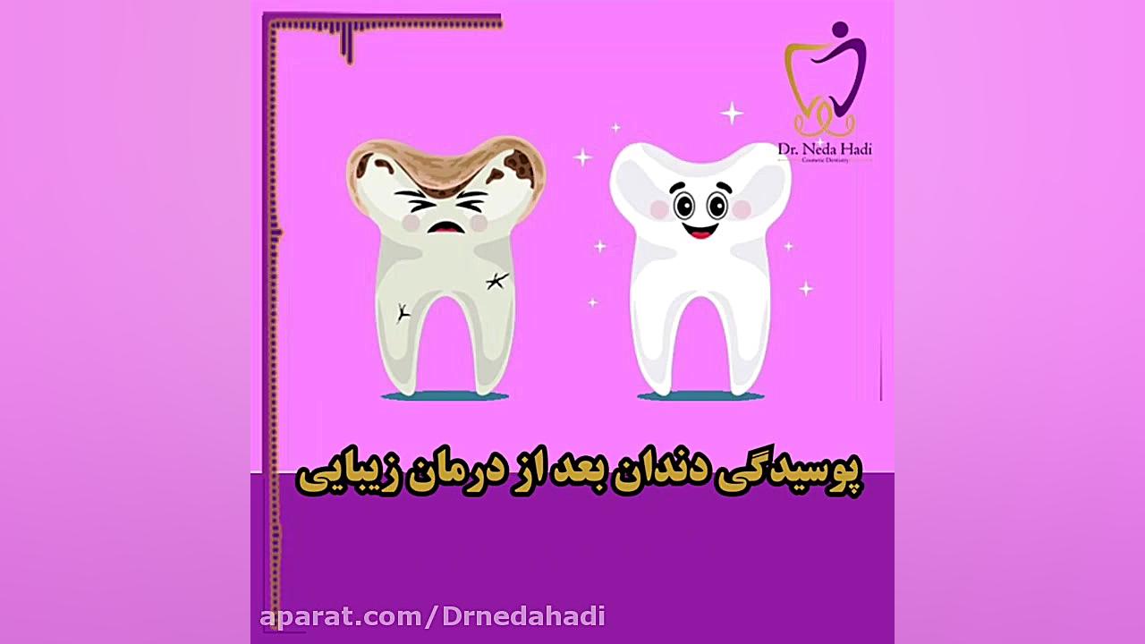 پاسخ دکتر ندا هادی به سوالات شما همراهان عزیز دکتر ندا هادی-دندانپزشک زیبایی