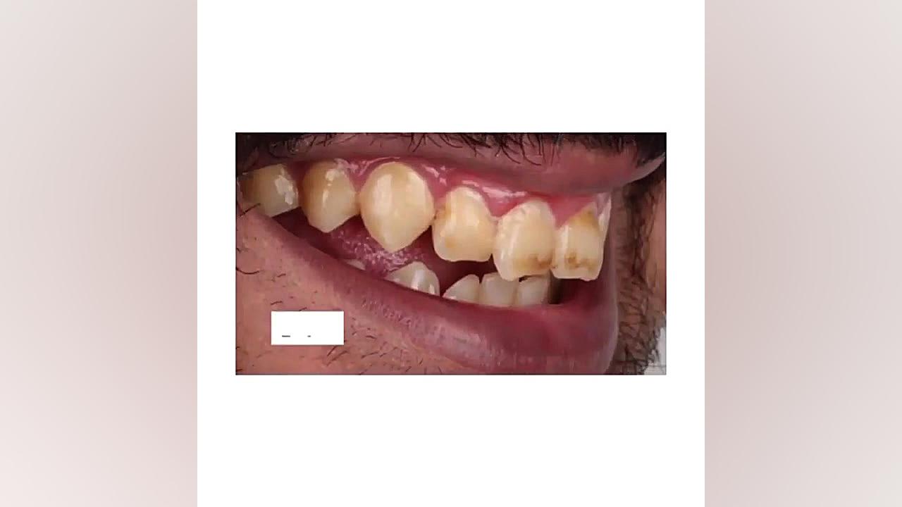 اصلاح طرح لبخند با درمانهای ترکیبی دکترمجیدقیاسی