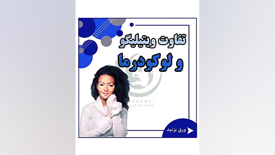 بین ویتیلیگو و لوکودرما تفاوت داره پیسی برص بهاق vitiligo کلینیک زیبایی