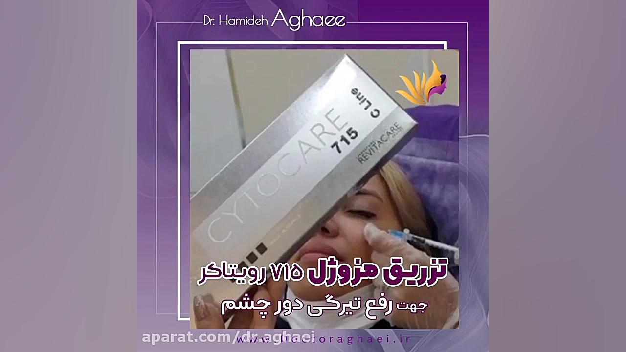 فیلم تزریق مزوژل رویتاکر 715 دکتر حمیده آقایی
