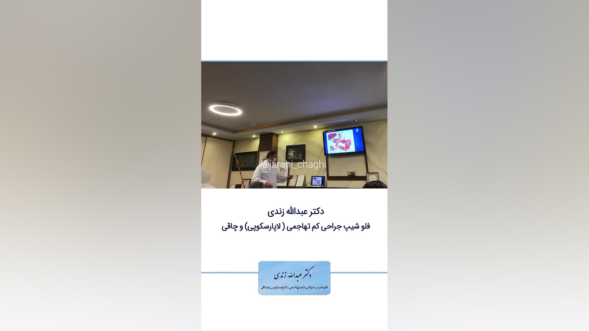 جراحی چاقی با روش دئودنال سوئیچ بیماری شوگرن
