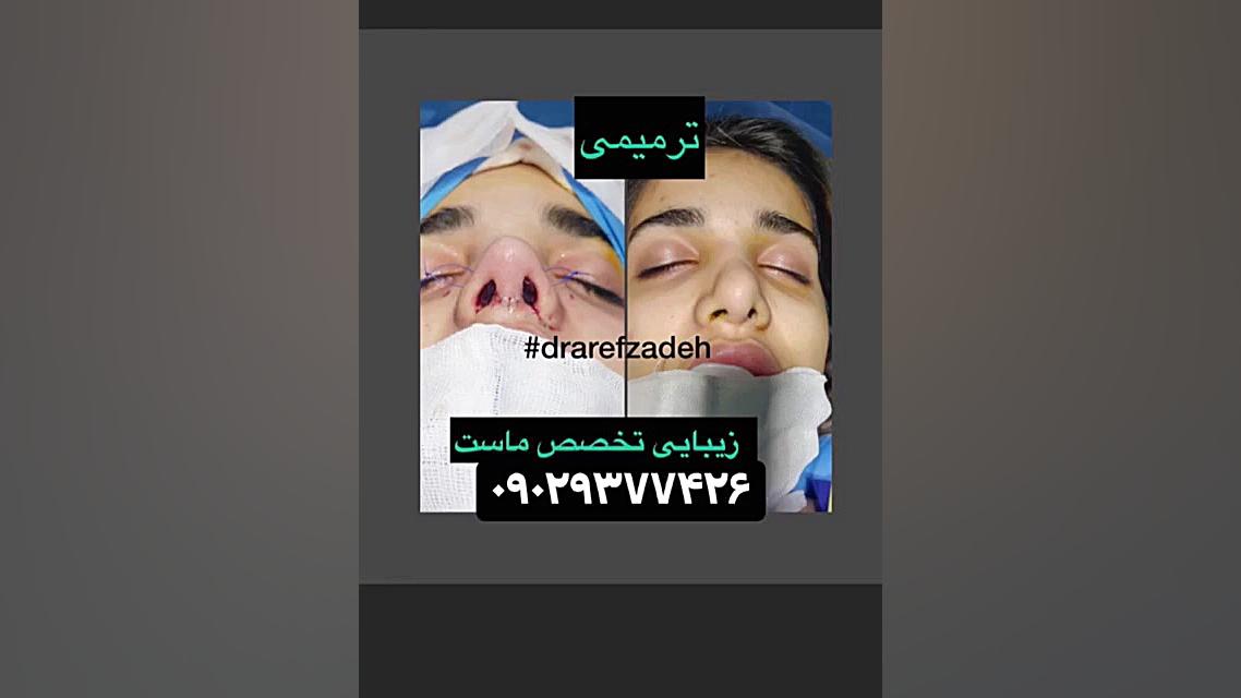 دکتراسماعیل عارف زاده، جراح و متخصص گوش حلق بینی، ساری دندان مصنوعی