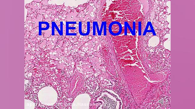 پاتولوژی اختصاصی. نعمت اللهی. lung1 منافذ باز پوست